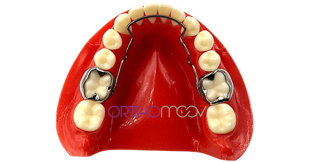 Arc lingual sur coiffes