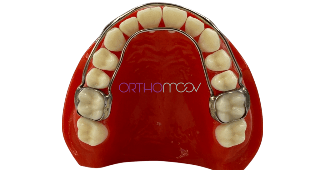 Double arc de Delaire