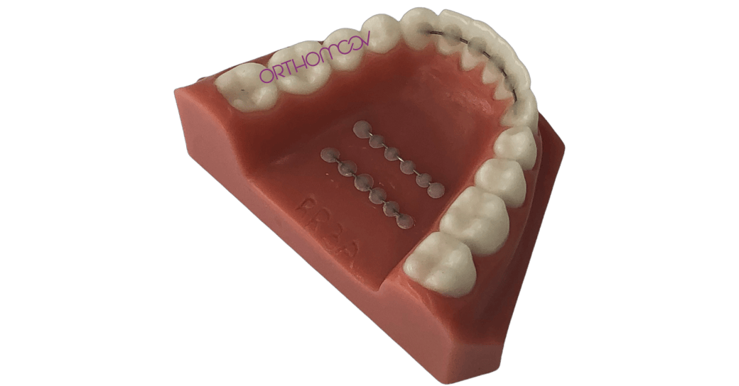 Fil pré-encollé avec transfert