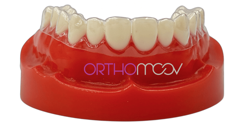 Thermoformage toutes épaisseurs